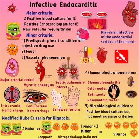 Infective Endocarditisdiagnosis And Treatment