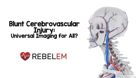 Blunt Cerebrovascular Injury Bcvi Universal Imaging For All Med