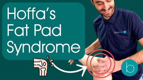 Hoffas Fat Pad Syndrome Infrapatellar Fat Pad Syndrome Hoffas Fat