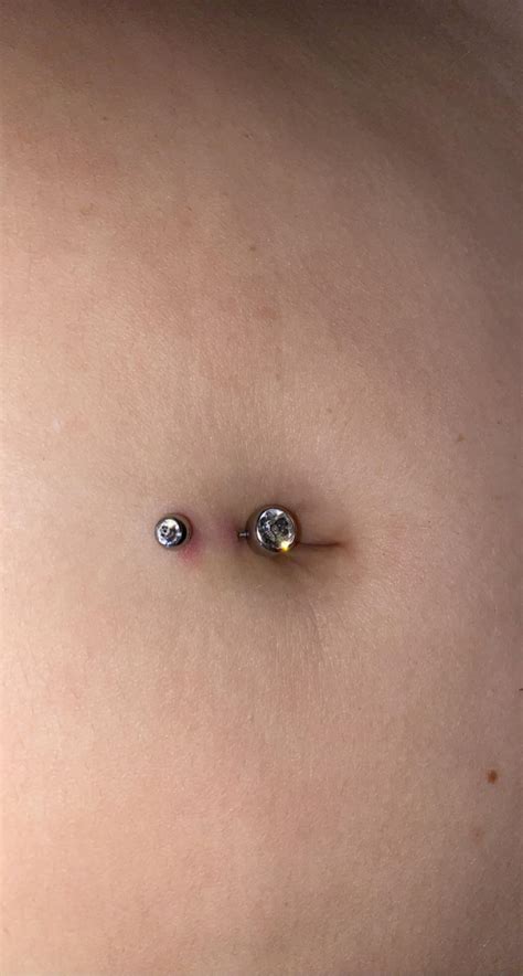 I Got My Belly Button Pierced 5 Days Ago Is This Redness Irritation Or Just The Natural Healing