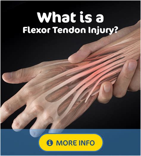 Finger Flexor Tendon Injuries