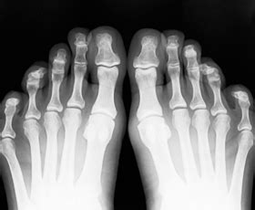 Diagnostic Imaging: X-ray, bone scan, MRI, ultrasound. Which test is