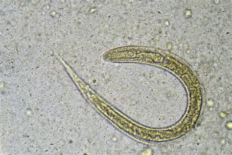 Causes Symptoms And Treatments Of Roundworm Facty Health