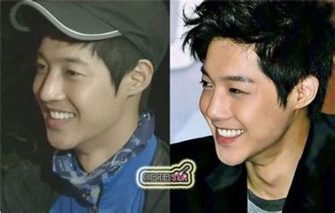 Kim Hyun Joong Plastic Surgery Of Nose Job Before After