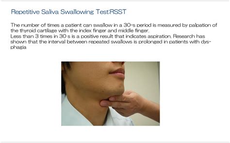 25dysphagia Evaluationscreening Test