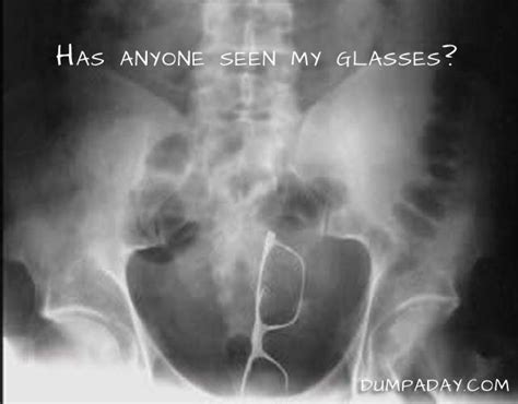 Amazing X Rays Of Random Objects Inserted Into Bizarre Places 15 Pics