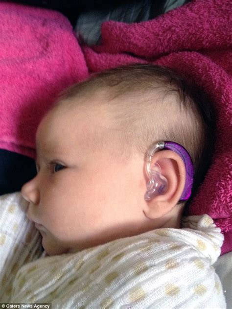 Mum Creates Colorful Accessories For Her Daughters Hearing Aids