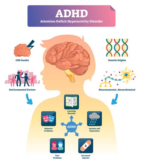 Adhd,Vector,Illustration.,Labeled,Attention,Deficit,Hyperactivity