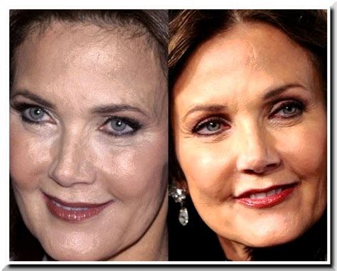 Did Lynda Carter Have Plastic Surgery Our Thin Focus Media