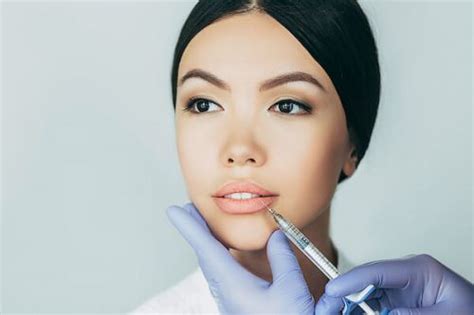 what you should know before getting lip filler injections
