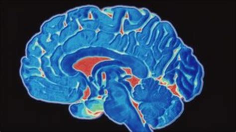 Slow Protein Clearance Clue To Alzheimers Bbc News