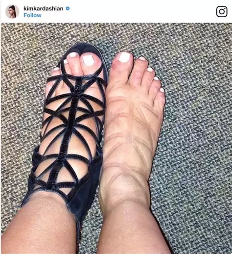 Kim Kardashian Having Plastic Surgery To Cure Cankles Cosmetic Town