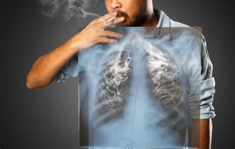 smoking and lung cancer kmh health blog