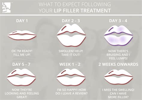 how will my lips feel after fillers