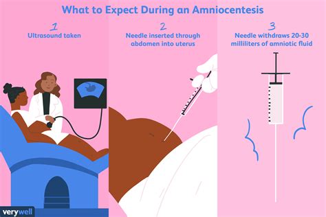 amniocentesis uses side effects procedure results