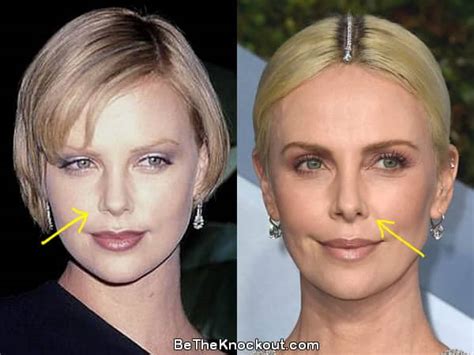 Charlize Theron Plastic Surgery Comparison Photos