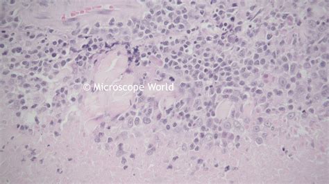 Microscope World Blog Tissue Captured With Hd Camera Under Microscope