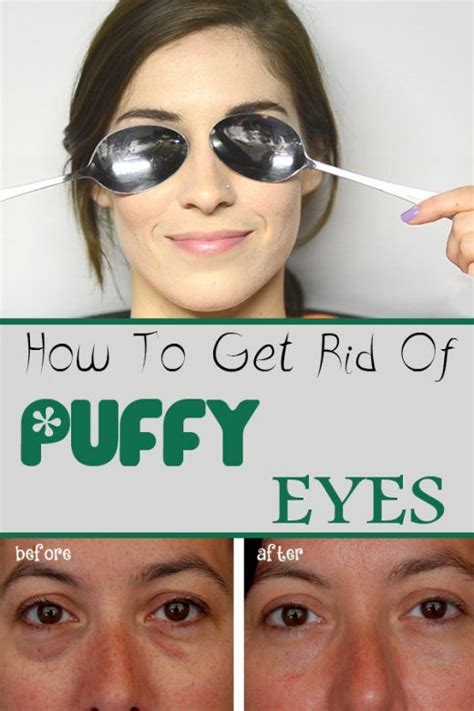 How To Get Rid Of Puffy Eyes Puffy Eyes Remedy Puffy Eyes Eye Bags