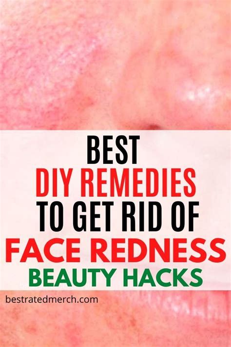 Quickly Get Rid Of Face Redness With These Diy Home Treatments Red Face Remedies Red Rash On