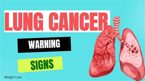 8 Lung Cancer Warning Signs Lung Cancer Symptoms Youtube