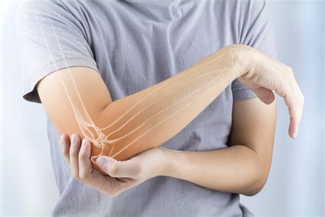 Ulnar Neuropathy At The Elbow