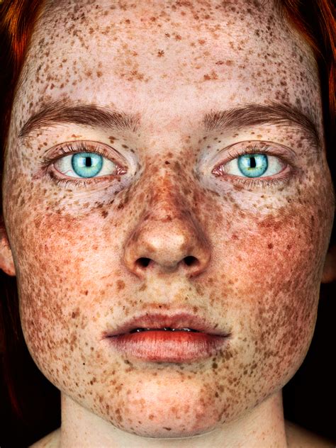 Brock Elbank Shoots Follow Up Portrait Of Face Behind The Freckles