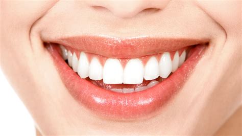 Diseño de sonrisa moda o necesidad Clínica Odontológica Dentioral
