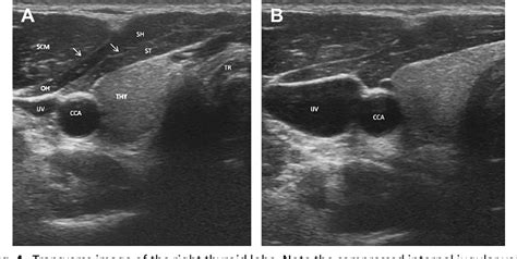 Figure 4 From Head And Neck Anatomy And Ultrasound Correlation