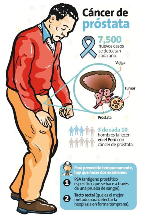 Cáncer de próstata es el que más crece Salud Peru