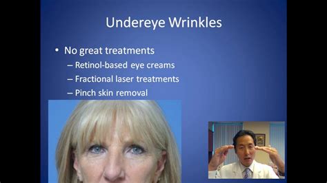 What S The Best Treatment For Undereye Wrinkles Consultation Dr Anthony Youn Youtube