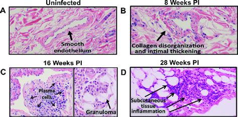 Histology Of Lymphatic Vessels And Surrounding Tissue A Un Infected