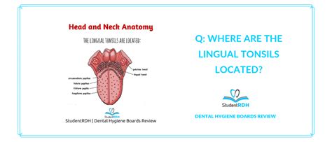 Q Where Are The Lingual Tonsils Located Studentrdh Blog