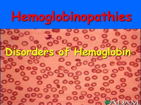 Ppt Hemoglobinopathies Powerpoint Presentation Id3308126