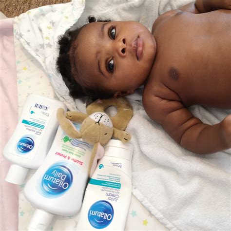 Dry Skin In Babieskids My Experience And Solution Everything