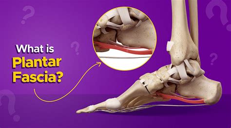 Understanding Plantar Fasciitis What You Need To Know Myfrido