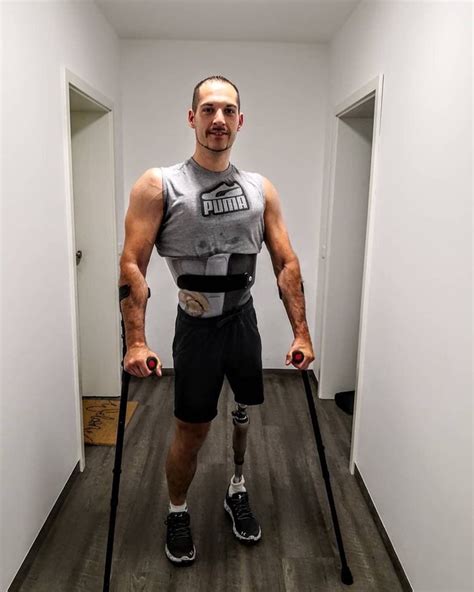 Hip Dis Prosthetic Leg Crutches Amputee