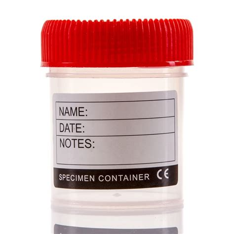 50x Transparent Specimen Containers With Label Sides Red Sample Pot