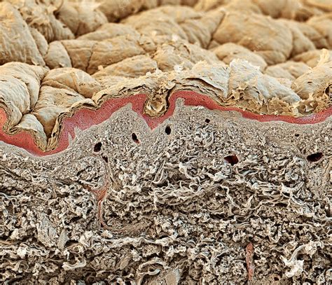 Skin Layers Sem Stock Image P7100438 Science Photo Library