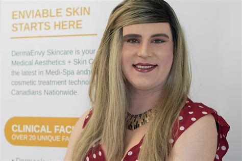 Brookes Laser Hair Removal Journey A Transgender Support Program