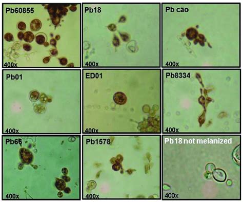 A Panel Of Paracoccidioides Spp Yeast Pb60855 Pb18 And Pbcão And P