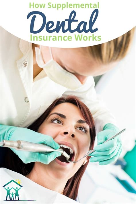 Maybe you would like to learn more about one of these? How Supplemental & Secondary Dental Insurance Plans Work | Dental insurance plans, Dental ...