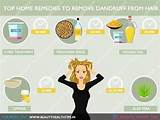 Images of Dandruff Home Remedies India