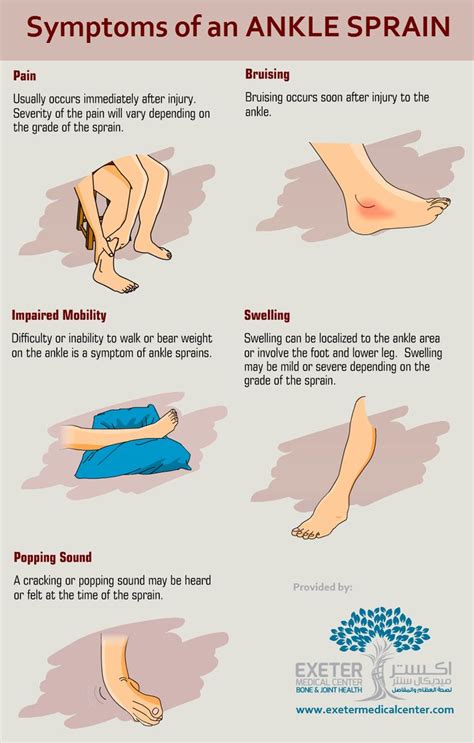 Ankle Sprain Bandage With Images Sprained Ankle Treating A