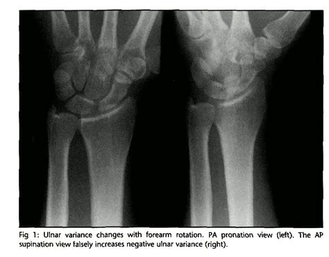 Ce4rt Radiographic Positioning Of The Wrist For X Ray Technologists