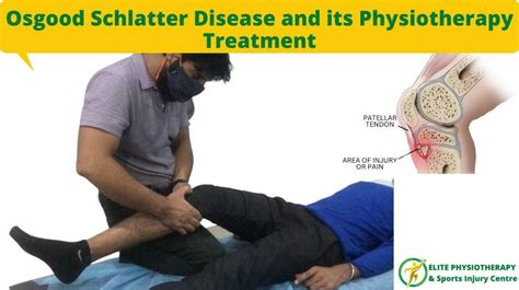 Osgood Schlatter Disease And Its Physiotherapy Treatment