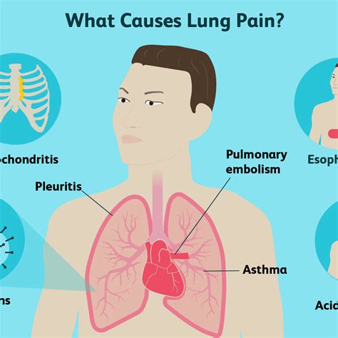 See full list on mayoclinic.org Pain In Middle Of Chest Under Ribs : Why Do I Have Pain Under My Left Rib Cage After Eating ...