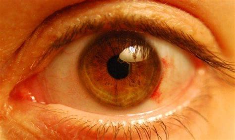 Pin On Blood Vessel In Eye