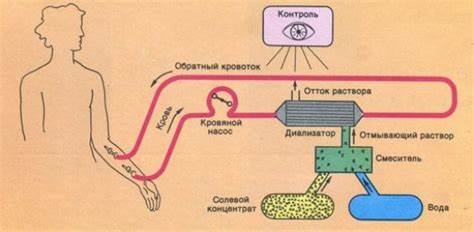 Диализ что это диета