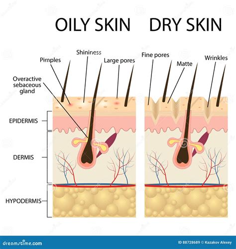 Human Skin Types And Conditions Stock Vector Illustration Of