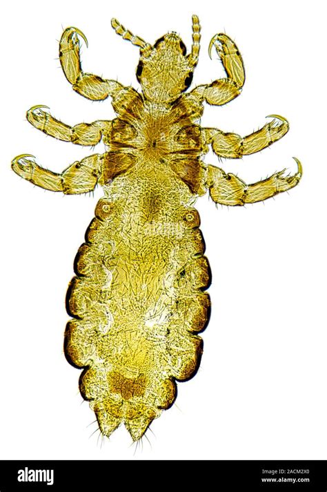 Head Louse Light Micrograph Of The Human Head Louse Pediculus Humanus